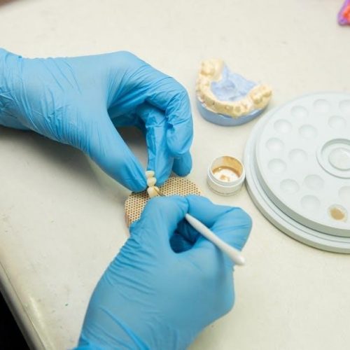 post op instructions for dental implants